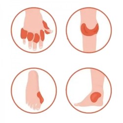 Пластири при подагра Облекчаване на болка и възпаление 8 броя